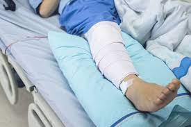 Pin On Joint Replacement