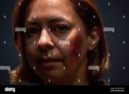 Domestic abuse awareness hi-res stock photography and images