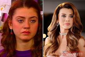 Dilan çiçek deniz 'estetik' iddialarına yanıt verdi! Dilan Cicek Deniz Estetiksiz Haliyle Adeta Bambaska Biri Sadece 2 Bolgemde Estetik Var Dedi Ama Galeri Takvim