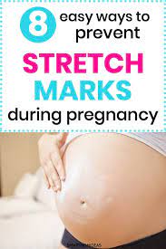 Real english version with high quality. How To Prevent Pregnancy Stretch Marks Smart Mom Ideas