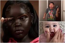 Krema za sunčanje SPF 30 smanjuje rizik od melanoma za 80 odsto