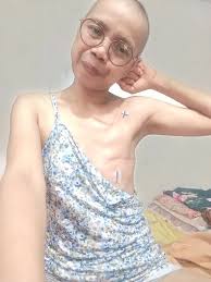 Finding strength in survival and scars