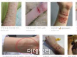 자해 이유는 가족의 해체, 높은 스트레스. ë‚´ê°€ ë¯¸ì›Œì„œ ìží•´ 4ë…„ìƒˆ 7ë°°ë‚˜ ì¦ê°€í•œ ì²­ì†Œë…„ ìží•´ ìƒë‹´