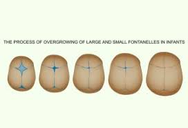 Fontanelles On Newborn Head Reasons Signs Treatment