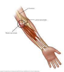 The elbow can be warmed directly with a heating pad. Golfer S Elbow Symptoms And Causes Mayo Clinic