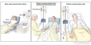 Critics argue that it is unethical to charge patients for. Stem Cell Transplants In Cancer Treatment National Cancer Institute