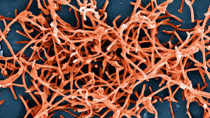 An outbreak of a wildly deadly virus on the doorstep of the nation's. Diagnosing Ebola In The Field The Brink Boston University