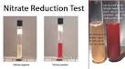Nitrate Reductase Test - m