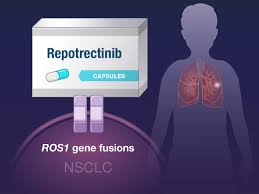 Image result for ROS1 Inhibitor