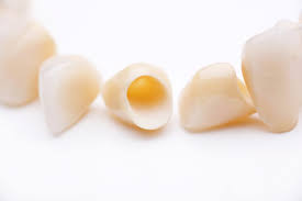 Zahnkrone Alle Infos Zu Anfertigung Und Pflege Dental Magazin