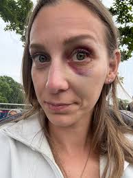 🚨 Black Friday Deal still LIVE 🚨 If you're looking for a new bat or  glove, now is the time to contact us! Especially if you are looking for  Hype Fire or