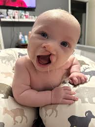 Just doing some tummy time after I blew out my diaper and mommy had to get  it from all off of my back 😊🫢