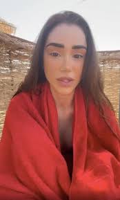 Veronica Biasiol šla s kůží na trh: V emotivním videu přiznala, že má  vitiligo