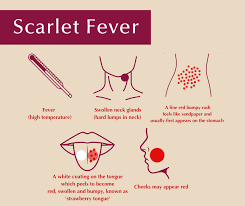 Image result for Scarlet Fever