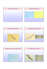 Grátis: 2022 - Aulas 2, 3, 4 e 5 - Urinálise - Material Claro e Objetivo em  PDF para Estudo Rápido