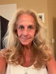 HAIR GROWTH… you want to know about Obvi Collagen and all these products?  Yes I take them ALL! My before picture is in the photos! I had broken,  short, damaged, terrible receding