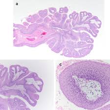 Image result for Centrostigma papillosum