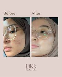 Profile for 4ever Young w Dr's Secret