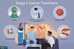 Image result for stage iv lung cancer what to expect after treatment
