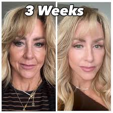 The girls who get it