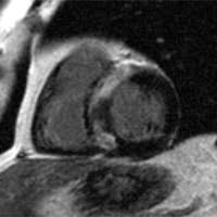 Die schonung sollte solange beibehalten werden, bis der arzt wieder grünes licht gibt. Kardiologie Und Angiologie Kernspintomographie Robert Bosch Krankenhaus