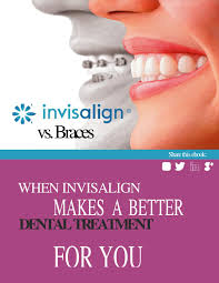 invisalign vs braces ebook by jhon wright issuu