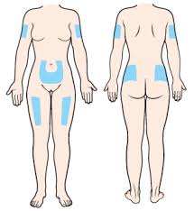 Image result for Subcutaneous Injection