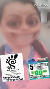 📣📣Aprovecha la Promoción Laser...