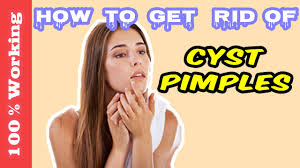 We did not find results for: How To S Wiki 88 How To Get Rid Of Back Acne Overnight