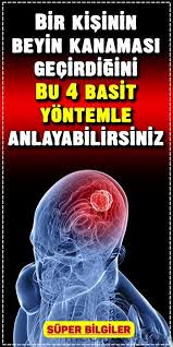 Bir Noroloji Uzmani Soyle Der Onemli Olan Beyin Kanamasi Teshisini Koymak Ve 3 Saat Icerisinde Bunu Tedavi Ettirmek Beyin Kanamasi Dogal Receteler Dogal Cilt
