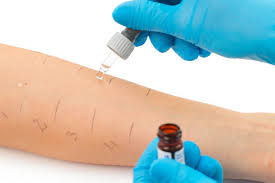 Aa 81 Allergies Et Allaitement