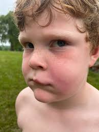 Jaxon needs top 10 votes to move on