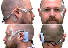 Development of the continuous ambulatory vestibular assessment (CAVA)  system to provide an automatic diagnosis for vestibular conditions:  protocol for a multicentre, single-arm, non-randomised clinical trial