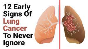 It reduces people's ability to breathe and their intake of oxygen. 12 Early Signs Of Lung Cancer To Never Ignore