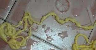 My husband nor myself is not infested with any intestinal parasites in my house. Man Pulls Out 17 Ft Tapeworm From His Behind Thai Man Suffering From Severe Stomach Ache Pulls Out 17 Ft Yellow Tapeworm From His Behind Trending Viral News