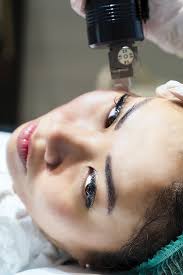 5 Beauty Treatments You Shouldn T Get In The Summer According To Skin Care Experts In 2020 Beauty Treatments Microneedling Exfoliate Dead Skin Cells