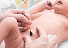 Asi Puedes Identificar Si Tu Bebe Tiene Granuloma Umbilical Y Como Debes Tratarlo Estilo De Vida Madres Univision