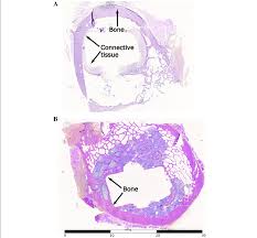 This slide contained a cross section of a very small bone, and you are looking at the entire thickness of the shaft of the bone. Histological Evaluation Of Cross Sectioned Bone After Stem Removal Download Scientific Diagram