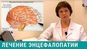 Дисциркуляторная энцефалопатия 1, 2 и 3 степени (описание). Encefalopatiya Youtube