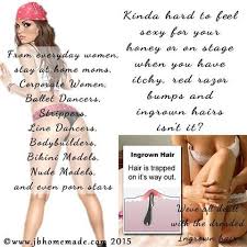 People can use clean tweezers to grab the hair and remove it. Hair Removal And Ingrown Hairs Jbhomemade Ingrown Hair Hair Removal Ingrown Hair Removal
