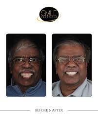 A confident smile changes everything 😊 Philipiah couldn't be happier with  his new upper denture, custom-crafted by Dr. Ariel Steinberger. A natural  look. A comfortable fit. A life-changing result.