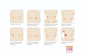 See a gp as soon as possible if you notice any symptoms of breast cancer, such as an unusual lump in your breast or any change in the appearance, feel or shape of your breasts. Breast Cancer Awareness Month 2015 Orchid Lingerie