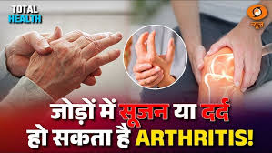 I Jodo ka
dard kaise threek kare I Joint Pain I