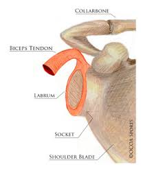 Shoulder diagram to mainly explain you about how your shoulder work and to describe every inner part of your shoulder including muscles, joints, and bones. Slap Tear Orlin Cohen