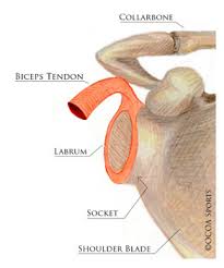 There are three main types of labrum tears: Slap Tear Orlin Cohen