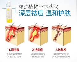 chamomile 精选植物草本萃取深层祛痘温和护肤1 清痘毒 天然本草萃取甘草清理痘源 痘毒2 祛痘痘 从根部祛除痘痘摆脱痘肌问题
