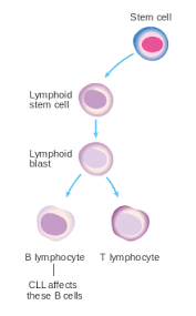 chronic lymphocytic leukemia wikipedia