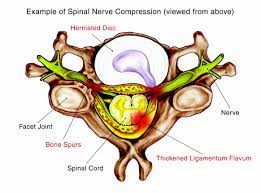 The head consists of two parts: 5 Causes Of Back And Neck Pain Or Discomfort
