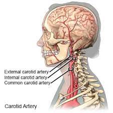The position of the branched carotid arteries is where a person can feel the pulse in their neck, just under the jaw. Carotid Artery Disease What You Need To Know