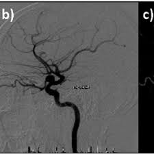 Dr zoran radovanović hospitalizovan je u koronarnoj jedinici radovanović je primljen na bolničko lečenje pre tri dana i kako je potvrđeno u upravi kc niš nema. Zoran Radovanovic Director General Manager Md Phd Md Phd Professor Of Radiology Medical School University Of Nis Klinicki Centar Nis Nis Center Of Radiology